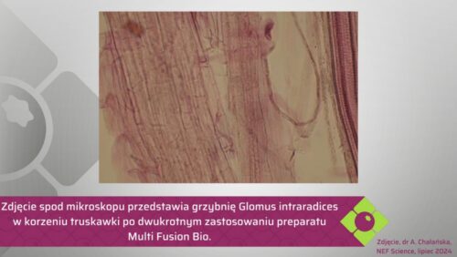 Zdjęcie mikroskopowe – korzeń truskawki zmikoryzowany przez grzyba Glomus